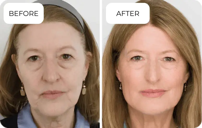 Naraskin Lab Skin Care user Katie R.