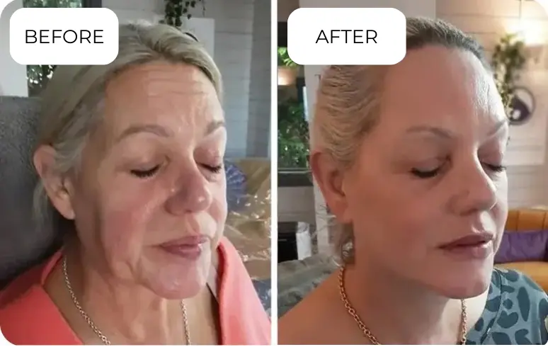 Naraskin Lab Skin Care user Carol G.